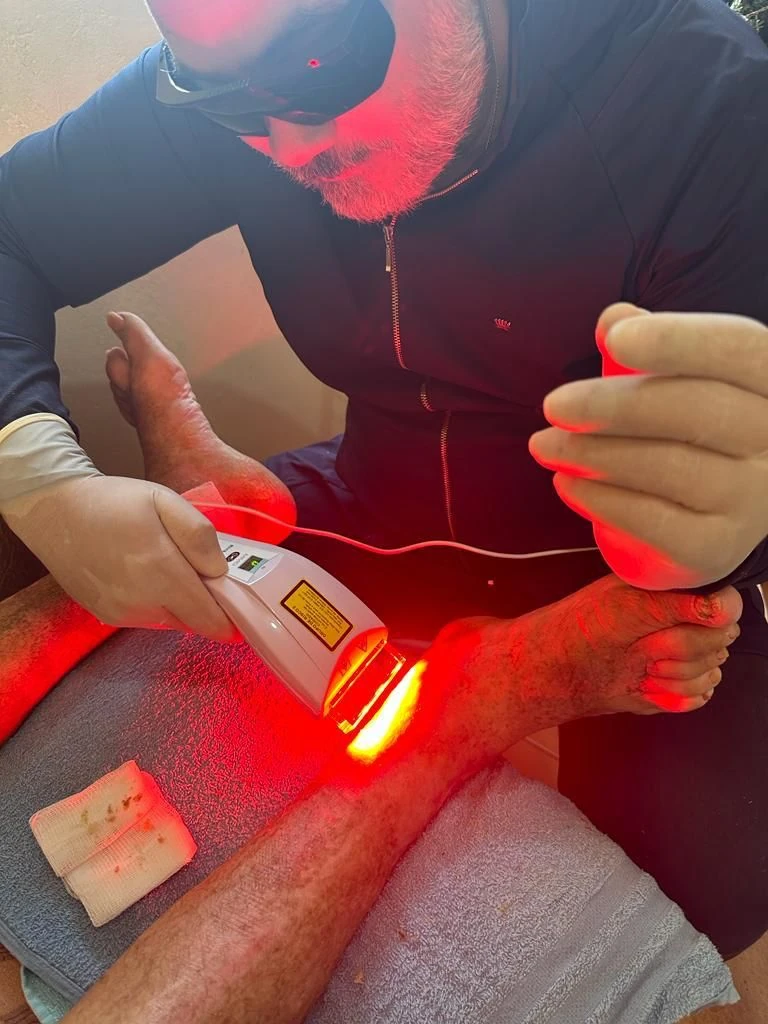 beneficios-da-laserterapia